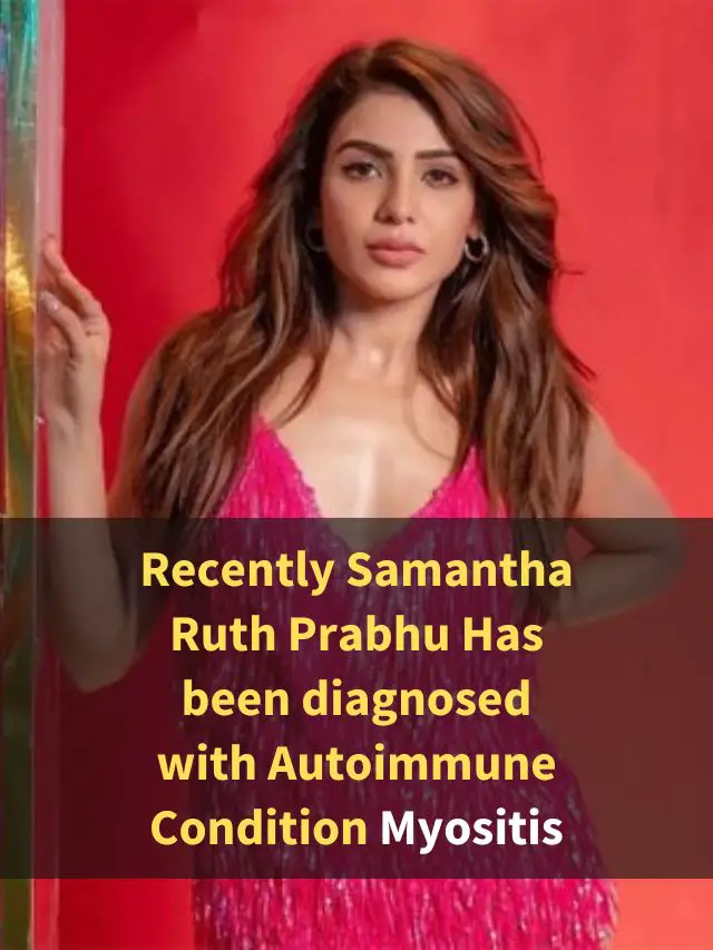 what-is-myositis-samantha-ruth-prabhu-has-been-diagnosed-with